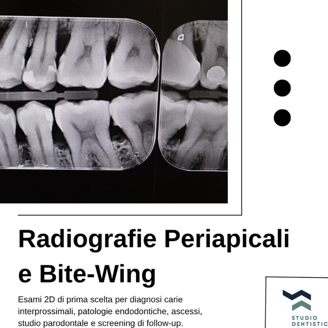 Carosello radiografie, periapicali e bite-wing